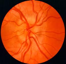 Neuro-ophthalmology_clip_image002